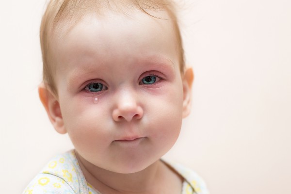 Virusni konjunktivitis kod dece